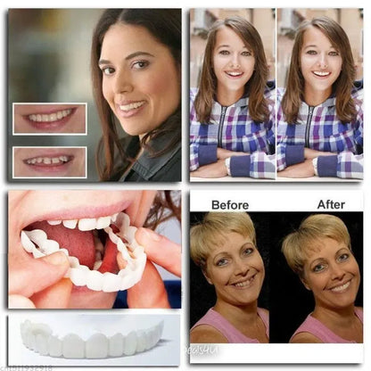 50% OFF Adjustable Snap-On Dentures