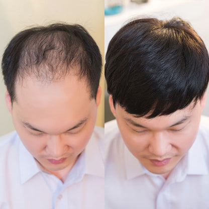 men's wig-FOREVER GOODBYE TO BALD HEAD ANXIETY