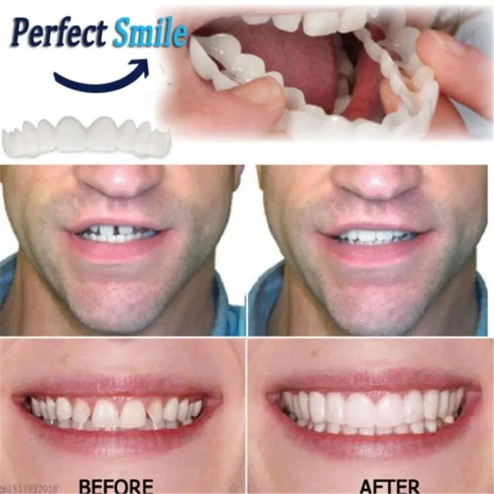 50% OFF Adjustable Snap-On Dentures